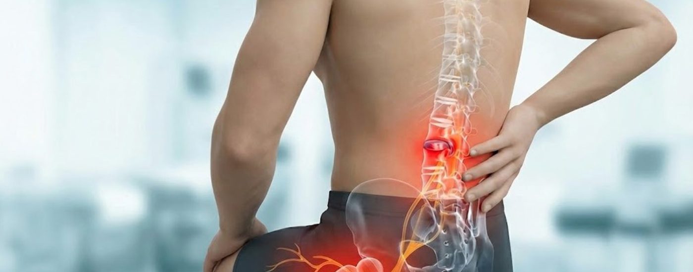 bel-fitigi bel-fitigi