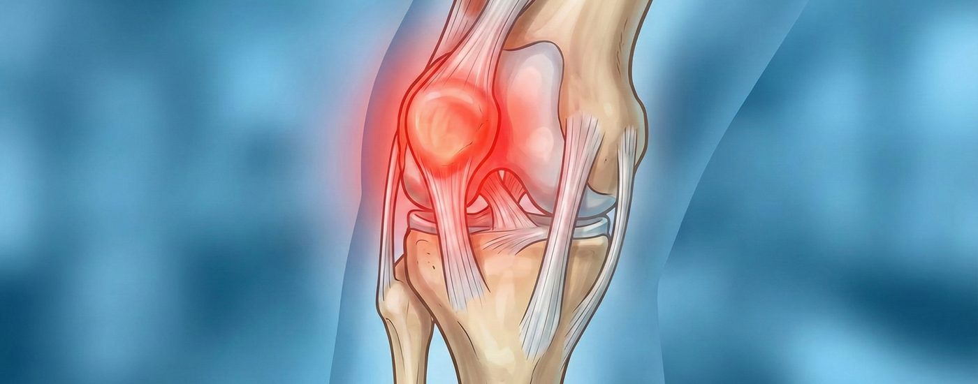 diz-kapagi-agrisi diz-kapagi-agrisi