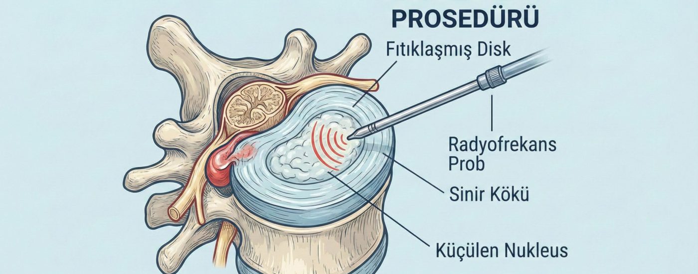 nükleoplasti nükleoplasti